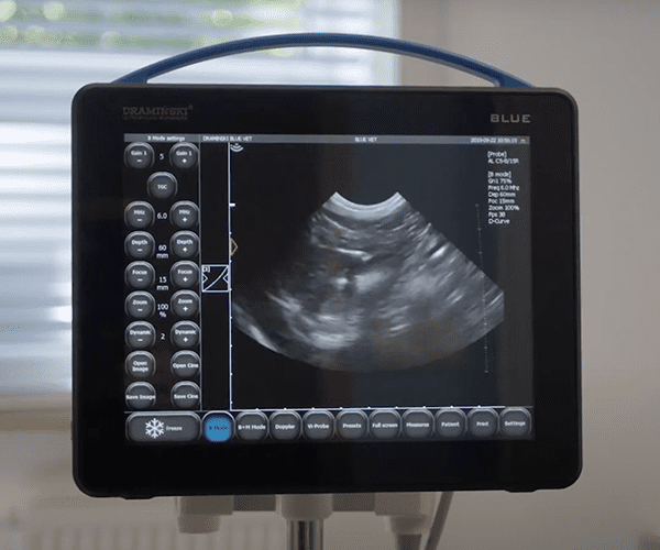 How To Make Sure Your Diagnostic Ultrasound System Is Operated Safely?