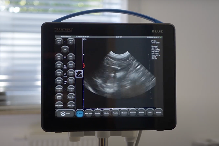 How To Make Sure Your Diagnostic Ultrasound System Is Operated Safely?