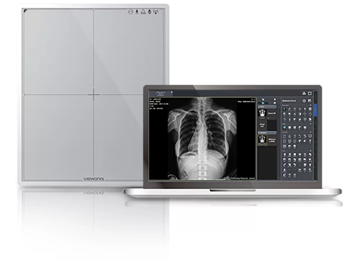 Portable X – Ray