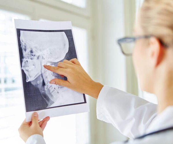 How Can A Wrong X-ray Diagnosis Hurt You?