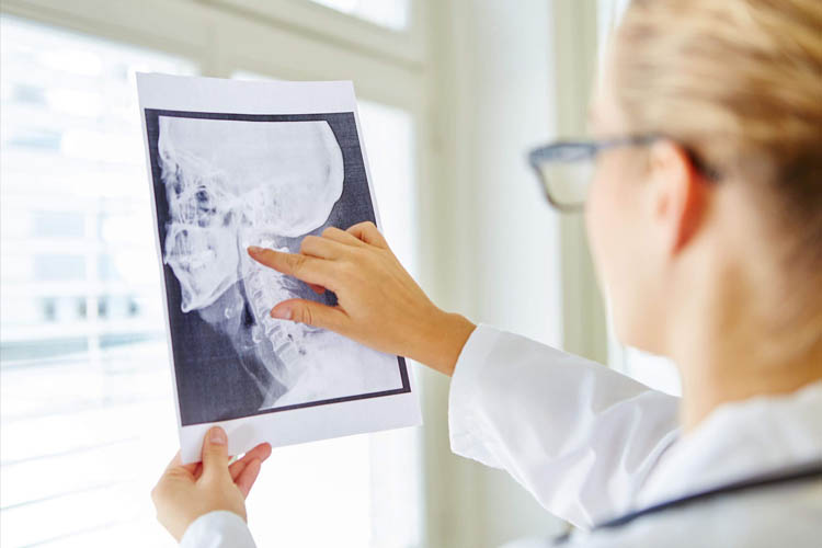 How Can A Wrong X-ray Diagnosis Hurt You?