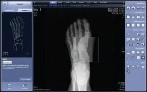 Podiatry X-ray Equipment