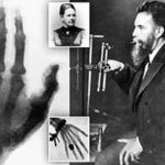 History Of X-ray Machine And Its Inventor Röntgen