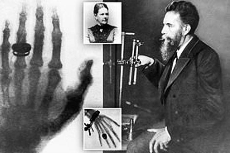 History Of X-ray Machine And Its Inventor Röntgen