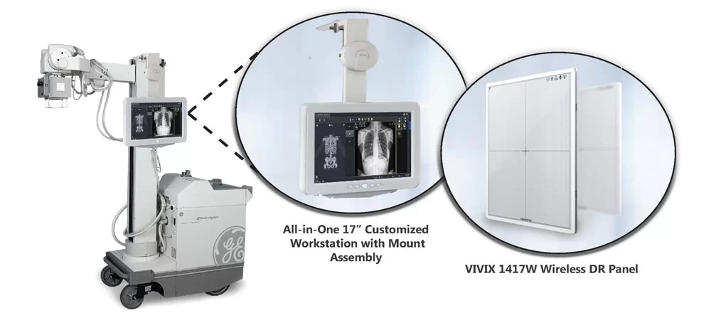 Portable X – Ray