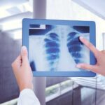 Early Diagnosis Of Covid With Ultrasound Equipment