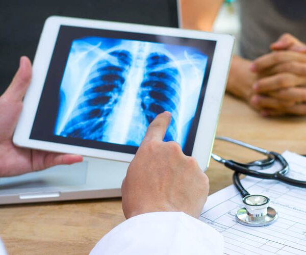 Portable X-ray Equipment Solutions To Fit Your Practice