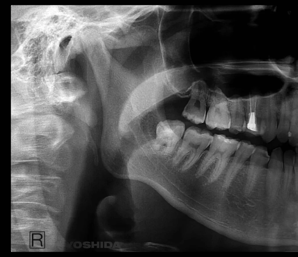 Patient Dental Systems