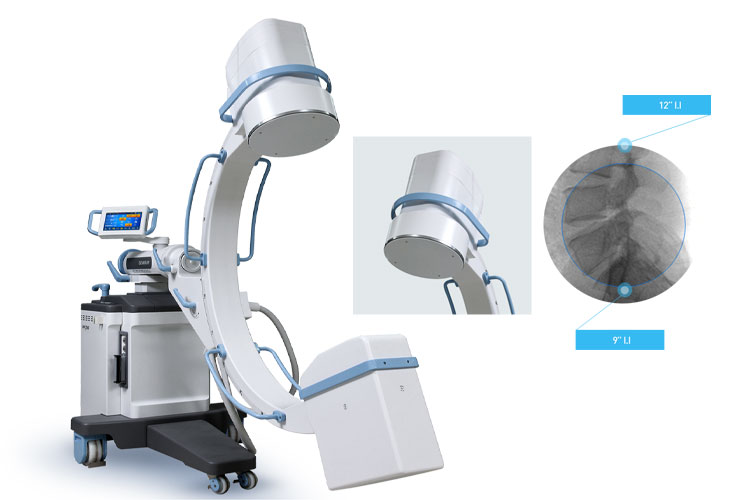 Advanced Imaging With The Zen 7000 C-arm